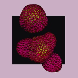 RGA expression in the shoot apical meristem